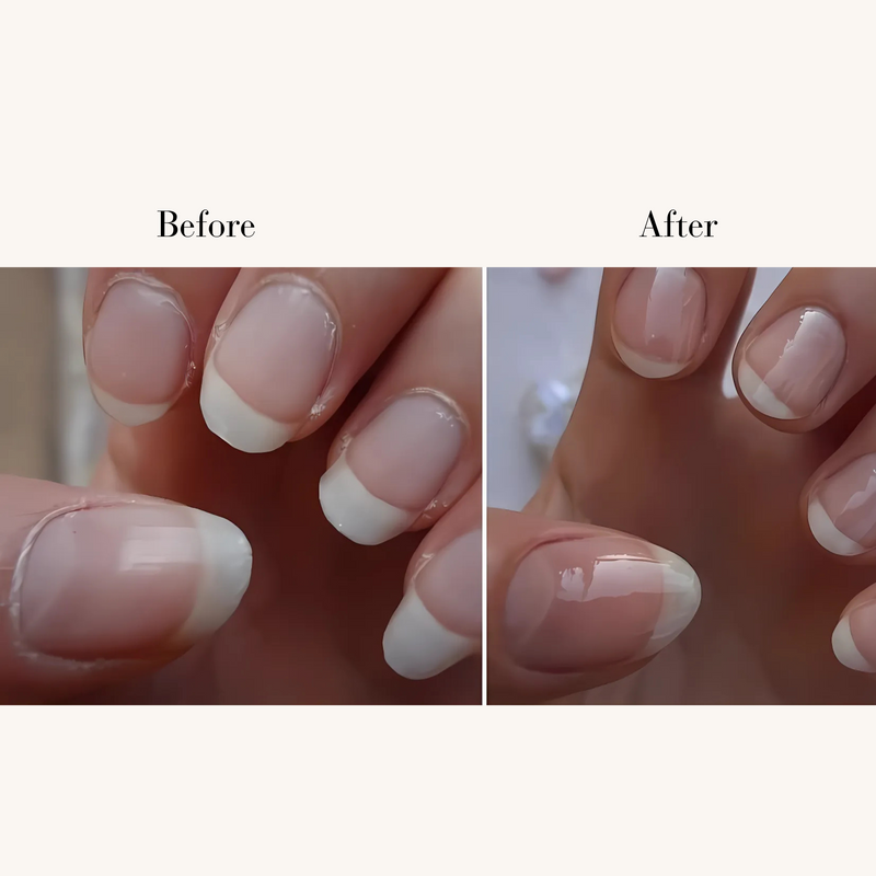 iilora Mini Nail trimmer